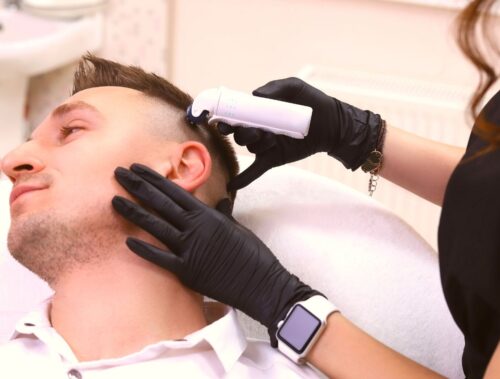 La Maison Beaute Vuadens - Traitement laser microneedling anti chute cheveux et repousse homme